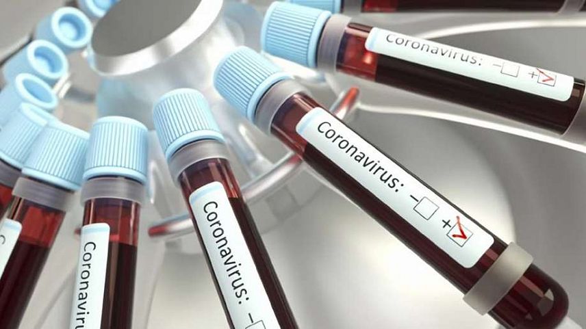 В Курской области коронавирус выявлен еще у 72 человек