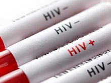 Роспотребнадзор открыл горячую линию по профилактике ВИЧ-инфекции 
